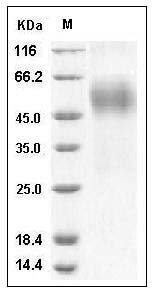 Human OBCAM / OPCML Protein (His Tag) SDS-PAGE