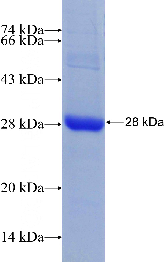 Recombinant Human RHOC SDS-PAGE