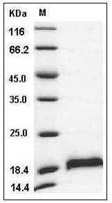 Mouse CDNF / ARMETL1 Protein (His Tag) SDS-PAGE