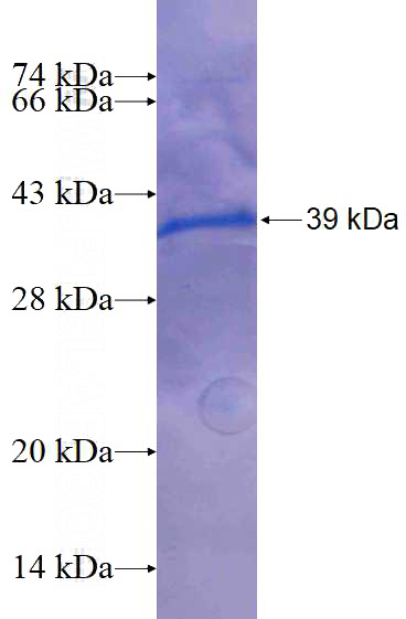 Recombinant Human SESN2 SDS-PAGE