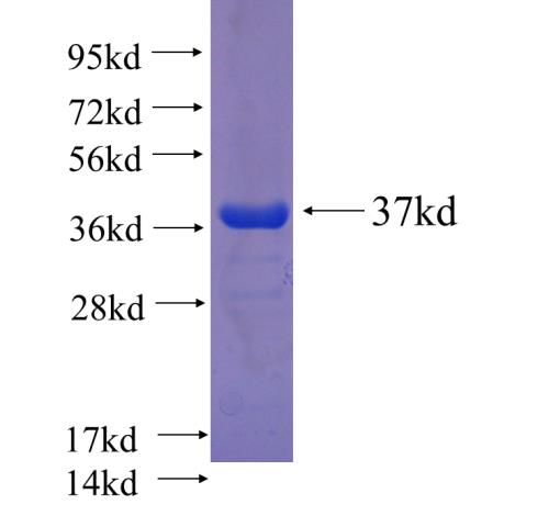 Recombinant human MAN2B1 SDS-PAGE