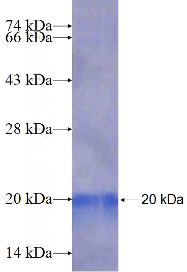 Recombinant Human RPL31 SDS-PAGE
