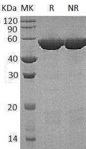 Human GSS (His tag) recombinant protein