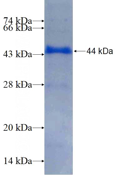 Recombinant Human HK2 SDS-PAGE