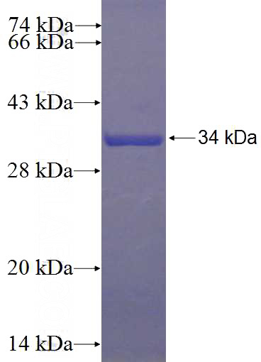 Recombinant Human COBL SDS-PAGE