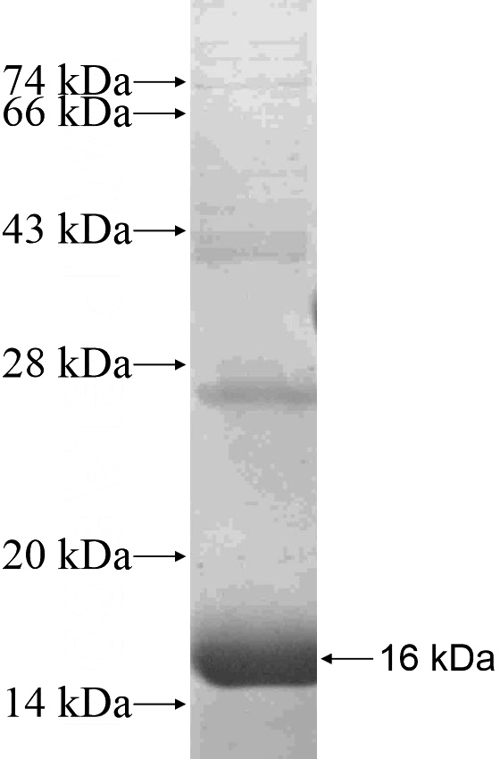 Recombinant Human CXorf27 SDS-PAGE