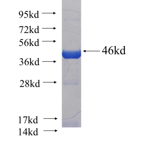 Recombinant human TXNDC16 SDS-PAGE