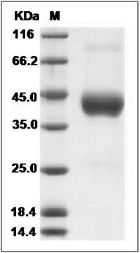 Rat CD64 / FCGR1A Protein (His Tag) SDS-PAGE