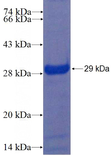 Recombinant Human ZNF713 SDS-PAGE