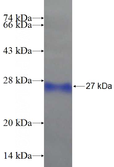 Recombinant Human SMCHD1 SDS-PAGE
