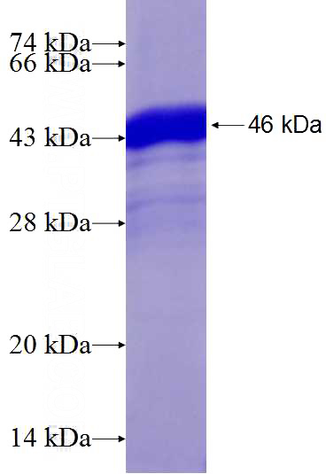Recombinant Human MYD88 SDS-PAGE