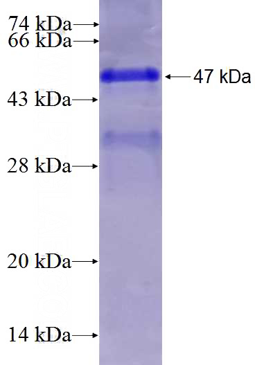 Recombinant Human WDR91 SDS-PAGE