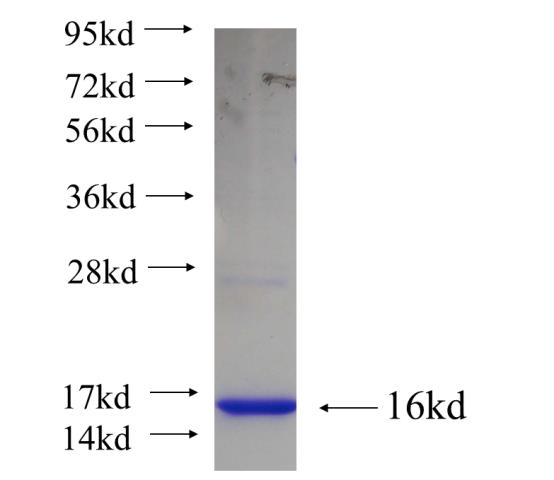 Recombinant human HOXB2 SDS-PAGE