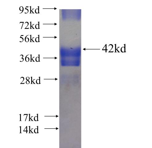 Recombinant human AHNAK SDS-PAGE