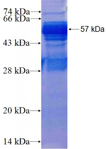 Recombinant Human CTNND1 SDS-PAGE
