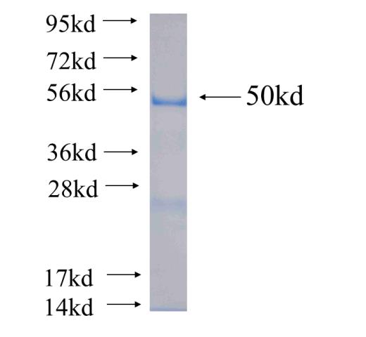 Recombinant human SH3GLB2(Full length) SDS-PAGE