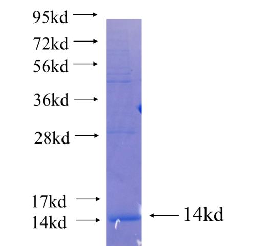 Recombinant human CLN6 SDS-PAGE