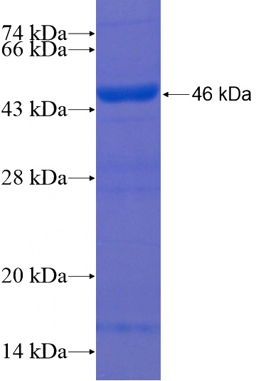 Recombinant Human ACSF3 SDS-PAGE