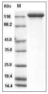 Human Semaphorin 5A / SEMA5A Protein (Fc Tag) SDS-PAGE
