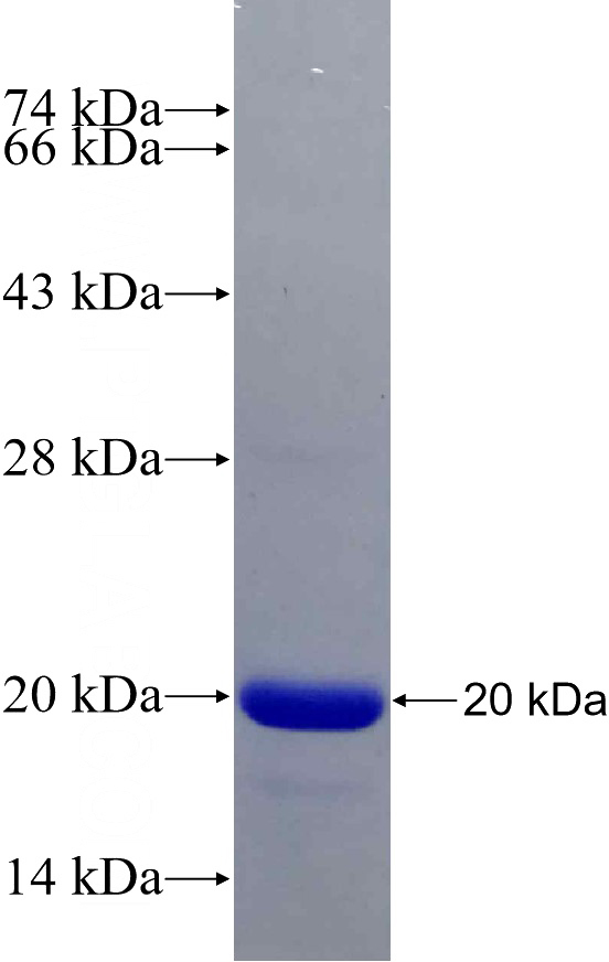 Recombinant Human RBM3 SDS-PAGE