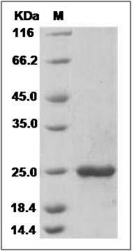 Mouse FGF7 / FGF-7 / KGF Protein (His Tag) SDS-PAGE