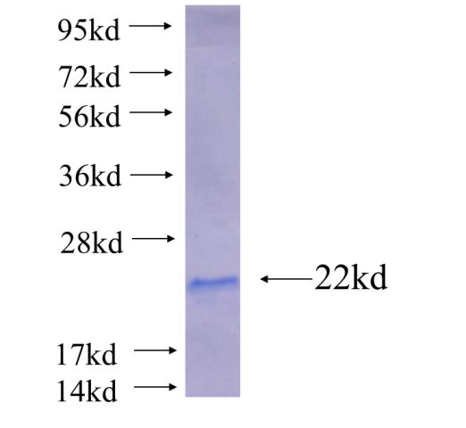 Recombinant human TP53RK SDS-PAGE