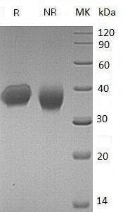 Human IL2RB/IL15RB (His tag) recombinant protein