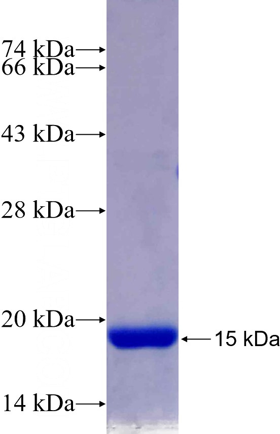 Recombinant Human LRIG2 SDS-PAGE