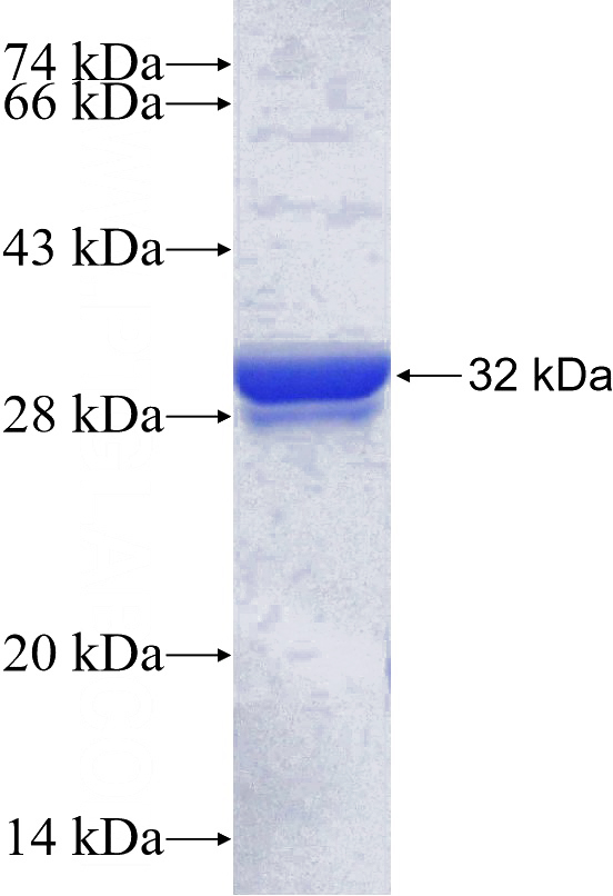 Recombinant Human SLC33A1 SDS-PAGE