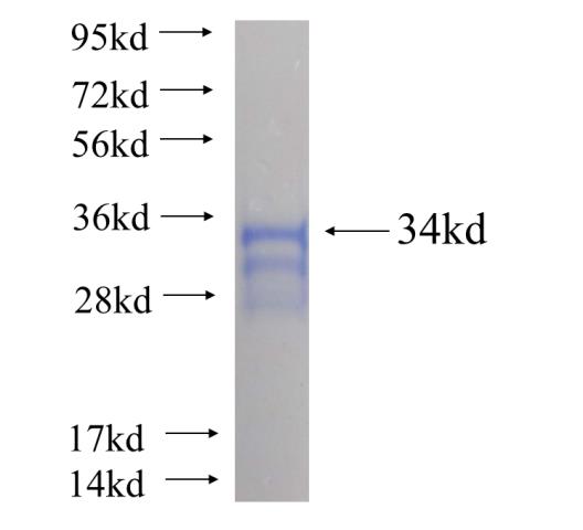 Recombinant human SLC1A3 SDS-PAGE