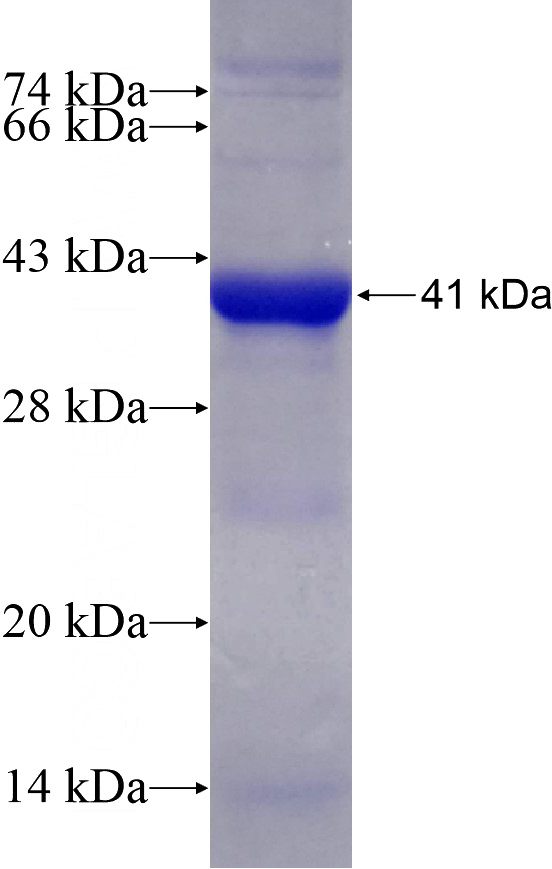 Recombinant Human FMNL1 SDS-PAGE