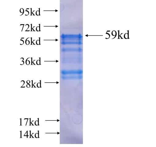 Recombinant human ZNF238 SDS-PAGE