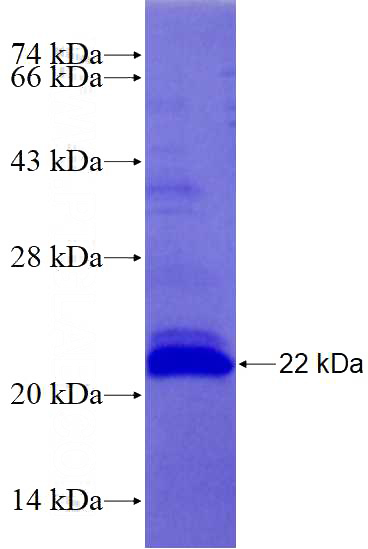 Recombinant Human MAPK10 SDS-PAGE