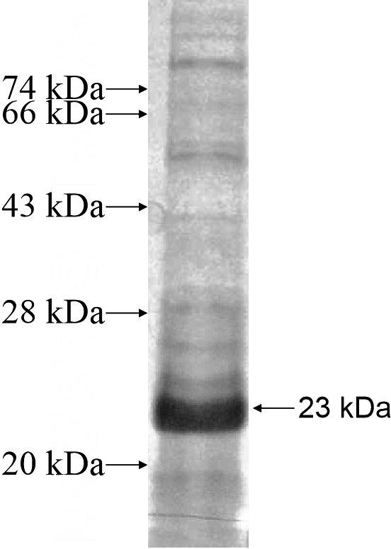Recombinant Human SPSB2 SDS-PAGE