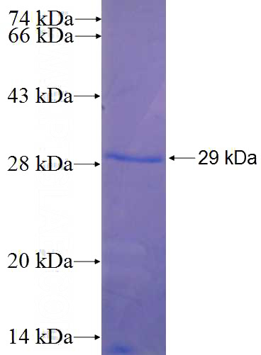 Recombinant Human SPTBN1 SDS-PAGE