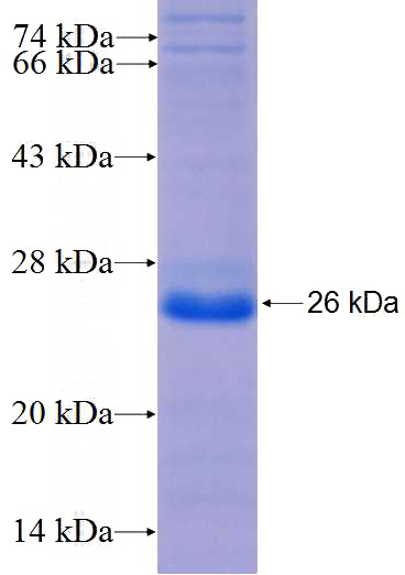 Recombinant Human SGEF SDS-PAGE