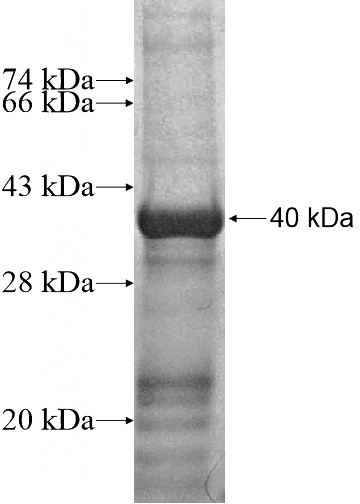 Recombinant Human ZNF222 SDS-PAGE