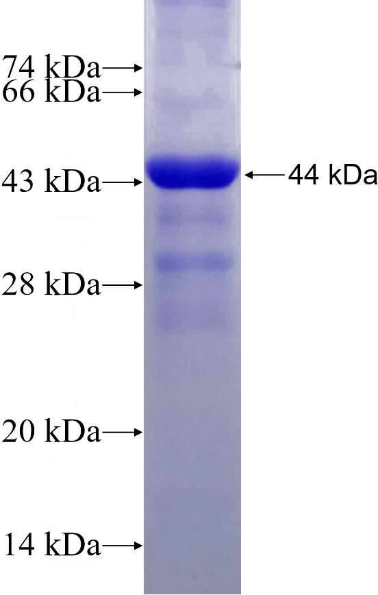 Recombinant Human RIN1 SDS-PAGE