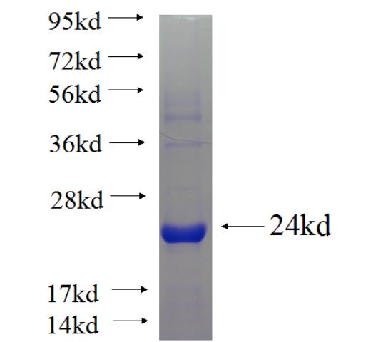Recombinant human C19orf54 SDS-PAGE