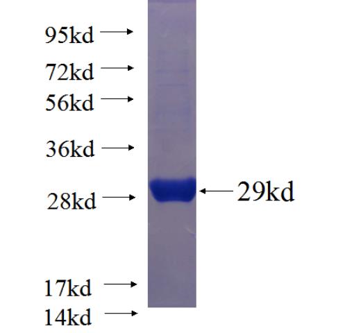 Recombinant human DUSP6 SDS-PAGE