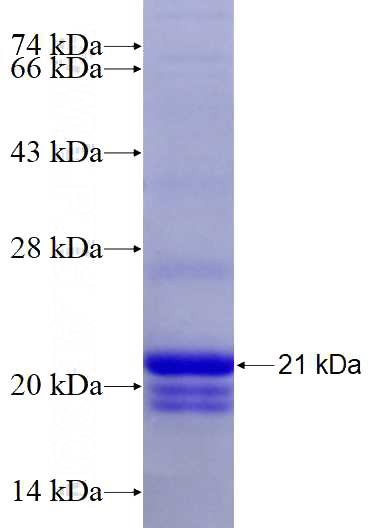Recombinant Human GPRC5C SDS-PAGE