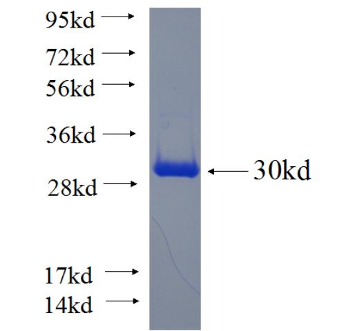 Recombinant human RAB3B SDS-PAGE