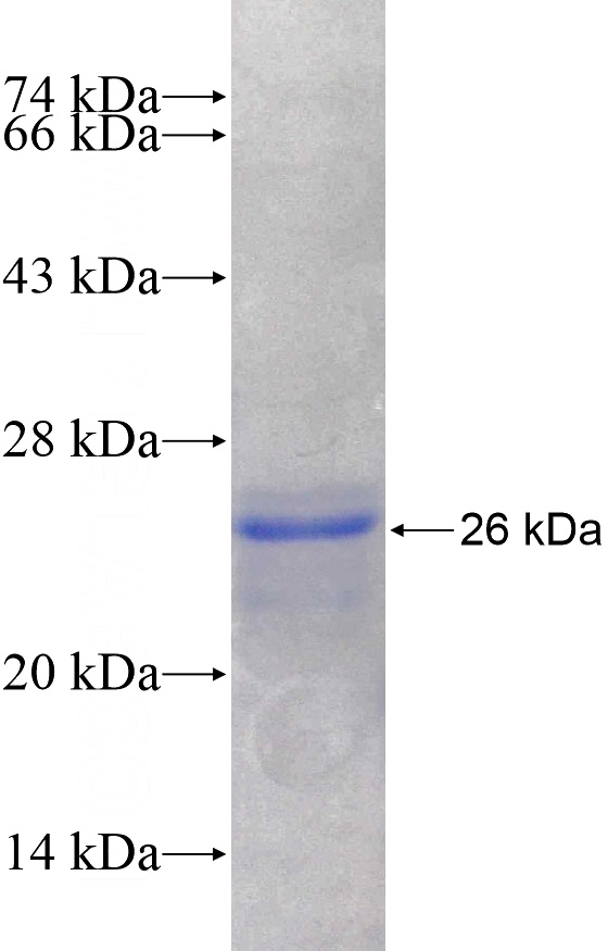 Recombinant Human CACNB2 SDS-PAGE
