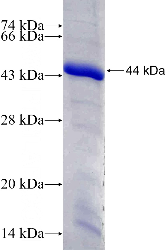 Recombinant Human TTC3 SDS-PAGE