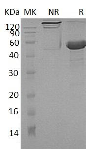 Human DPT (Fc & His tag) recombinant protein