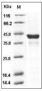 Human p38 alpha / MAPK14 Protein (His Tag) SDS-PAGE