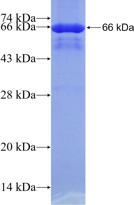 Recombinant Human UBXN1 SDS-PAGE
