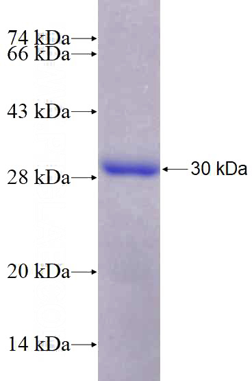 Recombinant Human FZD9 SDS-PAGE