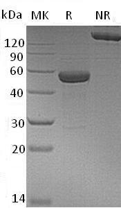 Human IL15RA + IL15 (Fc tag) recombinant protein
