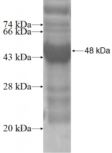 Recombinant Human RPL9 SDS-PAGE